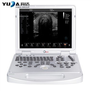 Notebook Scanner de ultrassom digital completo