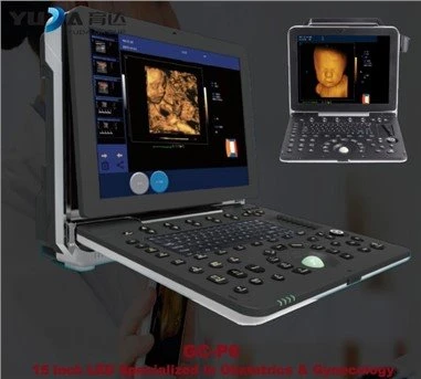 Máquinas portáteis de ultrassom OB GYN
